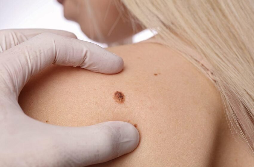  Pregledi mladeža na kompjuterizovanom dermatoskopu  bez uputa i besplatni